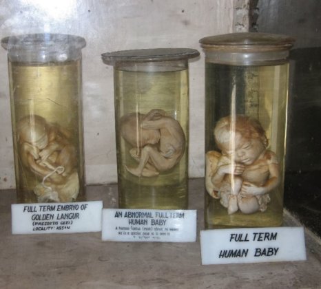 Embryo specimens in Indian Museum Kolkata